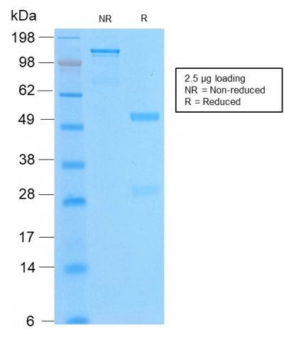 Data from SDS-PAGE analysis of Anti-bcl-2 antibody (Clone BCL2/2210R). Reducing lane (R) shows heavy and light chain fragments. NR lane shows intact antibody with expected MW of approximately 150 kDa. The data are consistent with a high purity, intact mAb.